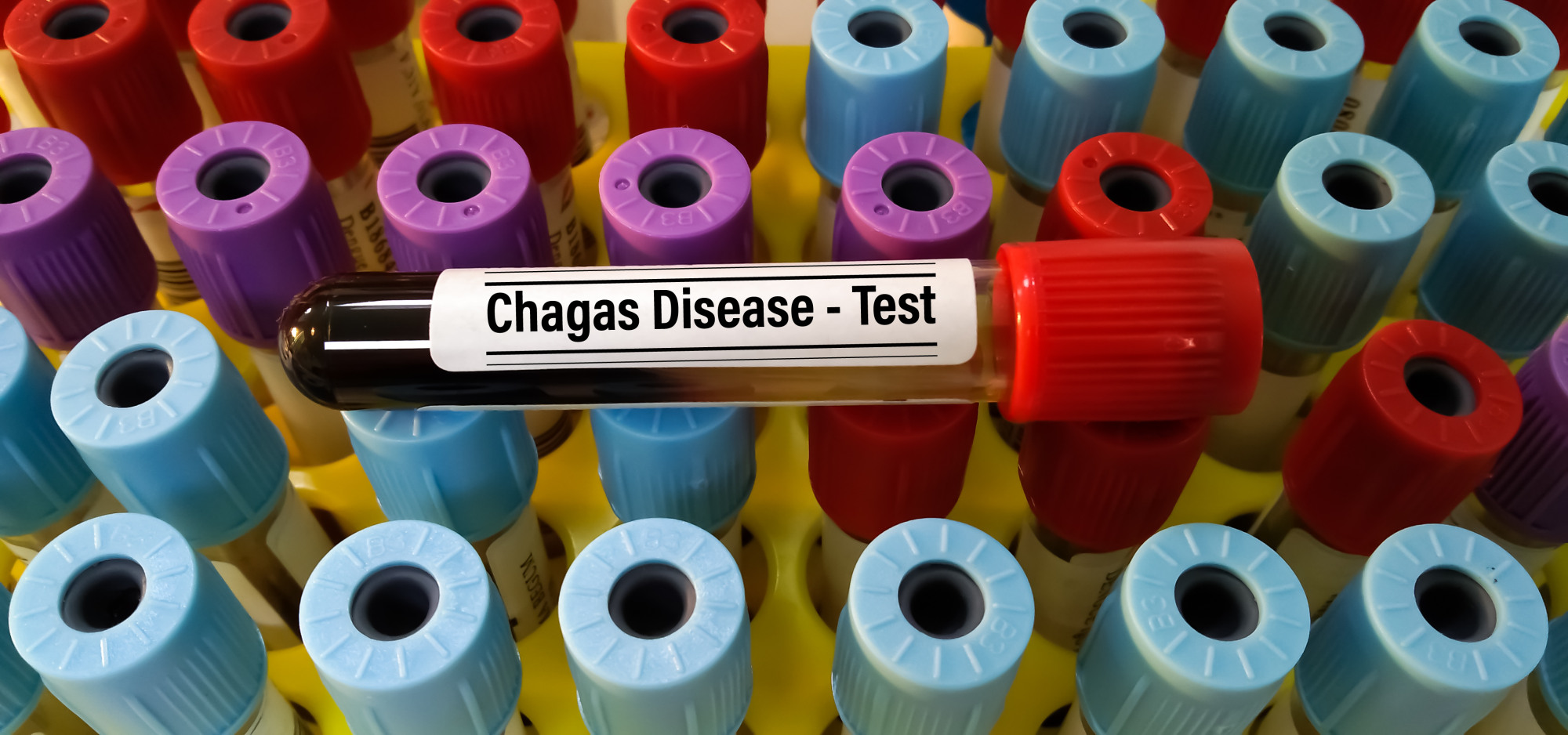 chagas test tube